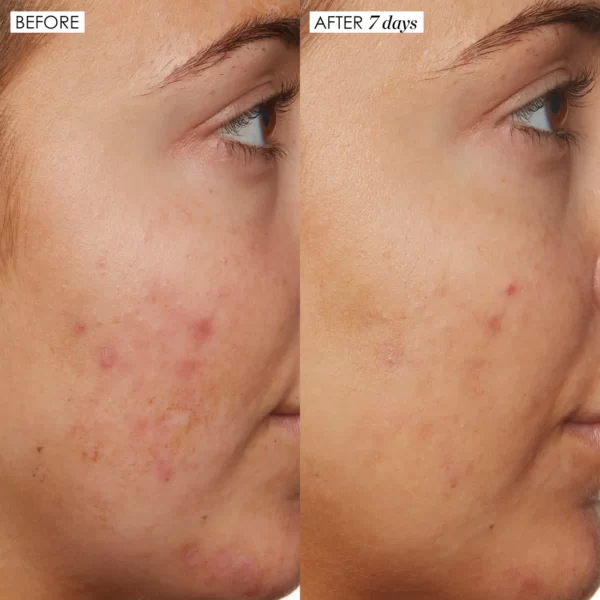 NIACINAMIDE SERUM - Image 7